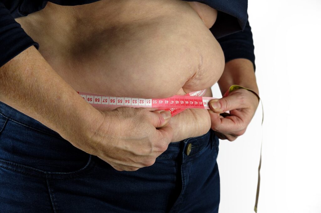 O diabetes tipo 2 tem forte associação com a obesidade visceral